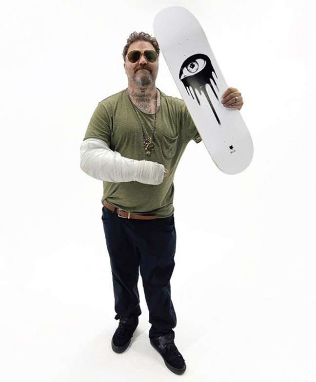Police search for “Jackass” star after escaping from the clinic