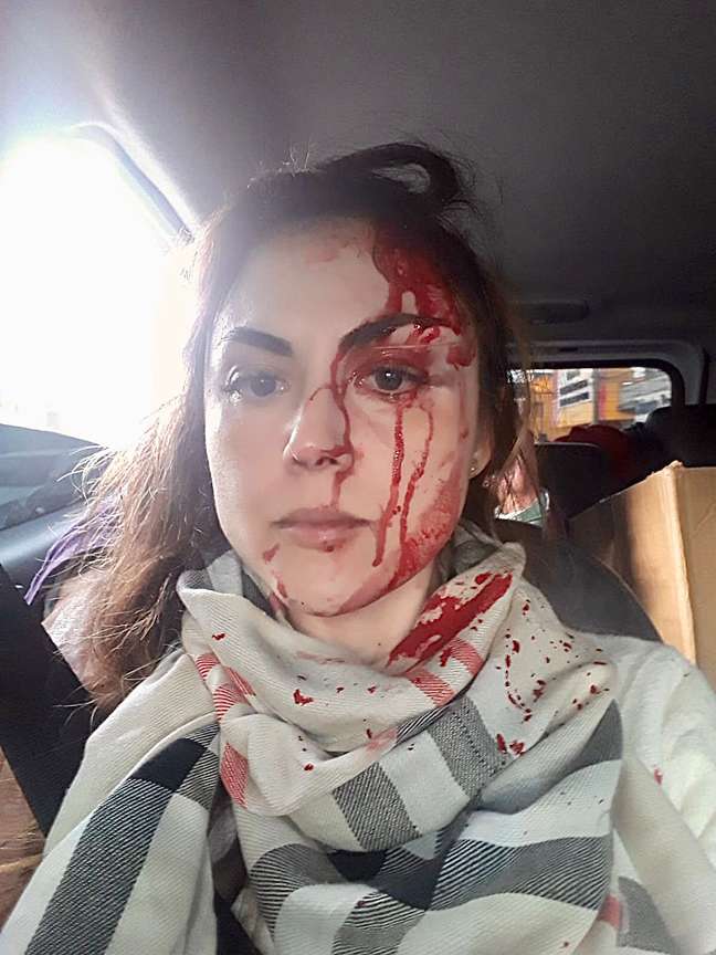 Vítima teve ferimentos no rosto após ser agredida por procurador em SP