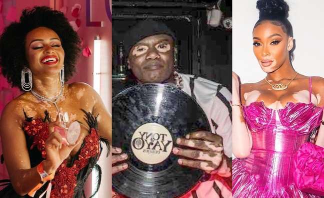 World Vitiligo Day: Who Are The Celebrities Who Overcome Prejudice With The Disease World Vitiligo Day: Who Are The Celebrities Who Overcome Prejudice With The Disease