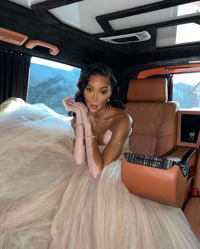 Winnie Harlow, model Winnie Harlow, model