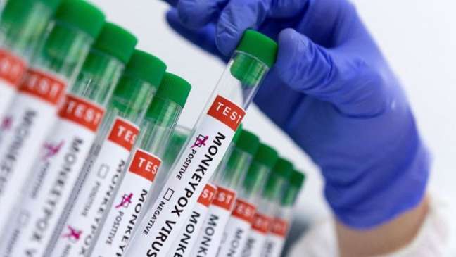 Imagem mostra tubos de teste para varíola dos macacos.
