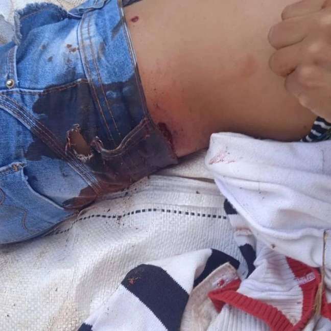 Indígena ferida durante confronto com policiais militares em Mato Grosso do Sul.