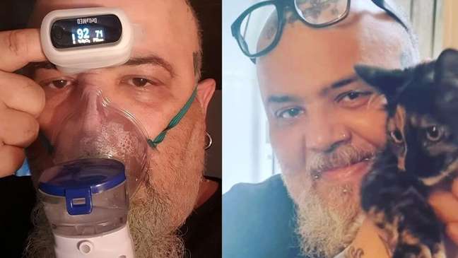 João Gordo revela que tem doença pulmonar crônica; especialista comenta
