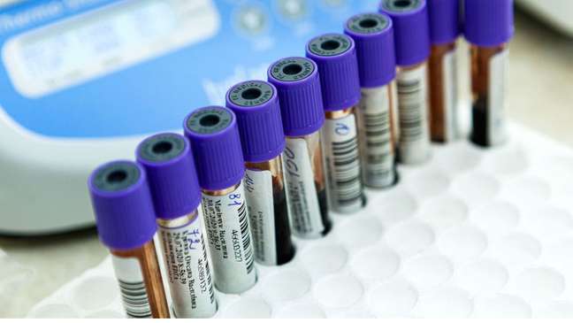 blood analysis blood analysis