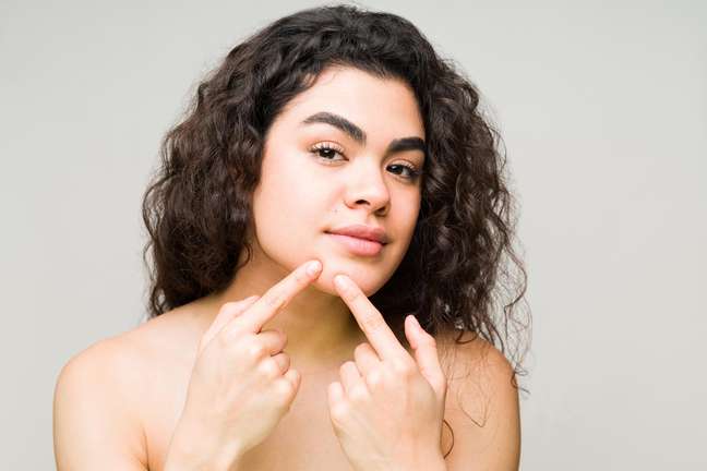 Acne scars have a solution, you know?  See how to treat