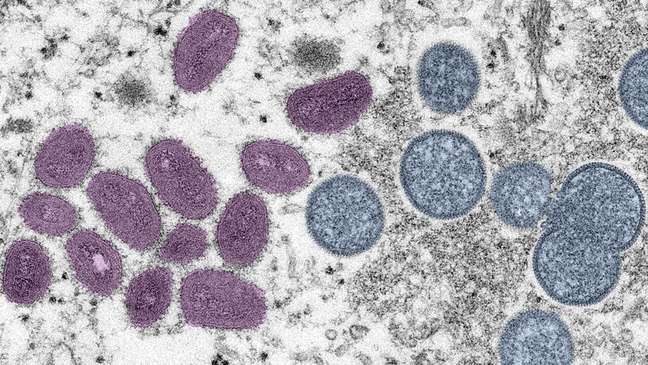 Laboratory image about viruses Laboratory image about viruses
