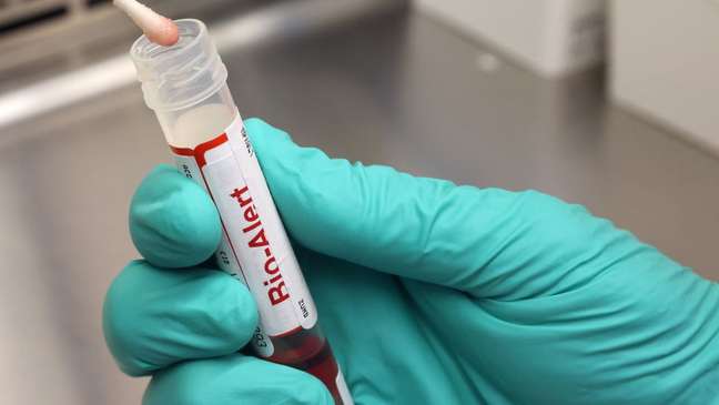 The virus, endemic to West and Central Africa, is now present in 65 countries The virus, endemic to West and Central Africa, is now present in 65 countries