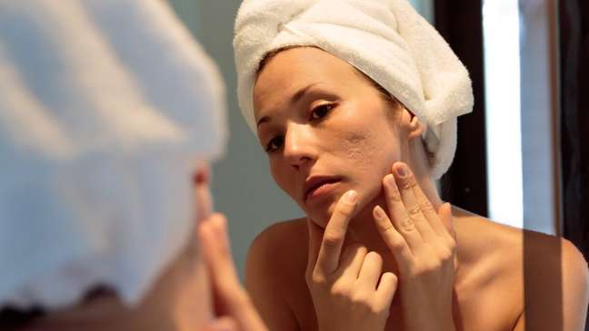 Discover the secrets of acne