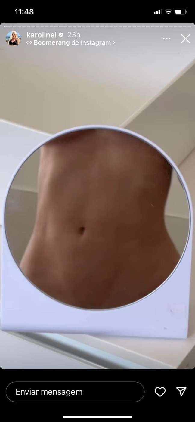 Karoline Lima shows her belly after giving birth. Karoline Lima shows her belly after giving birth.