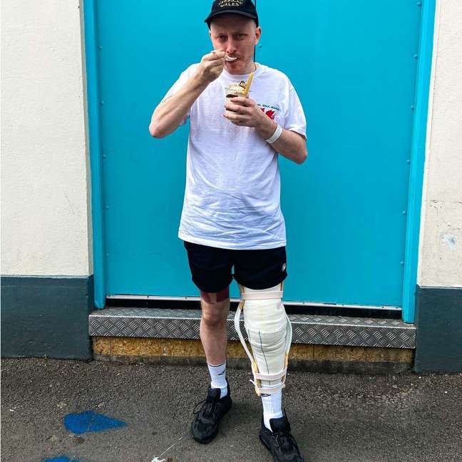 “Almost died from a scratch”: the British tells how he escaped the infection that “eats” the tissues of the body