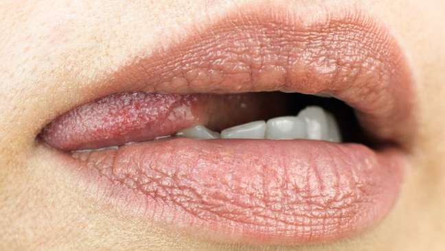 Contato entre a boca e a genital pode favorecer o surgimento de uma ou até várias ISTs
