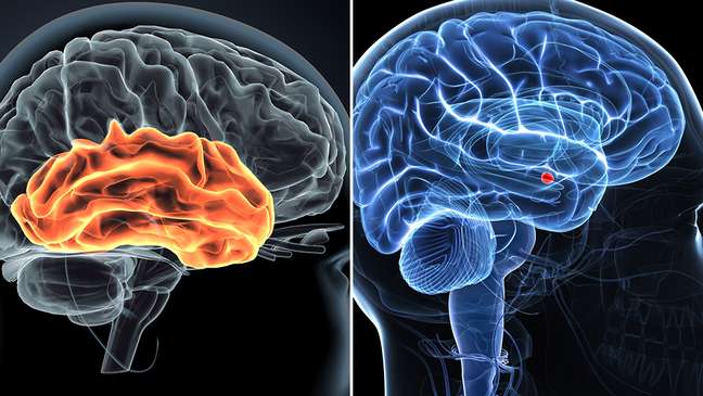 Os estudos indicaram uma interação entre o córtex auditivo (esquerda) e a amígdala (direita)