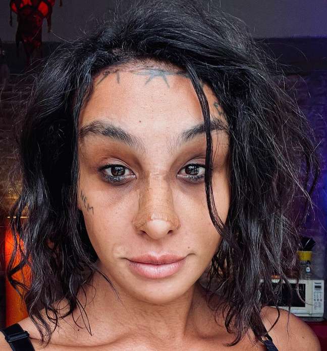 Linn da Quebrada shows the results of a facial feminization surgery