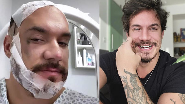 From botox to hair implants: see which celebrities have undergone cosmetic procedures From botox to hair implants: see which celebrities have undergone cosmetic procedures