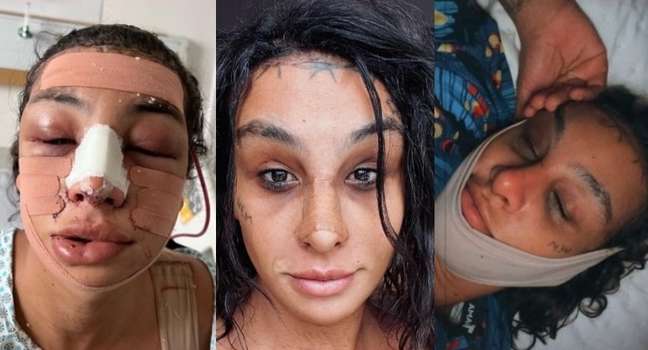 Lina undergoes procedures to look even more feminine Lina undergoes procedures to look even more feminine