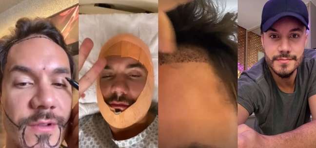 Eli, the heartthrob of 'BBB22', will soon have a lumberjack look, with a big beard Eli, the heartthrob of 'BBB22', will soon have a lumberjack look, with a big beard