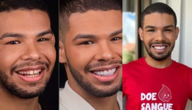 Smile, you are filmed: Vyni looks more sophisticated with new teeth Smile, you are filmed: Vyni looks more sophisticated with new teeth