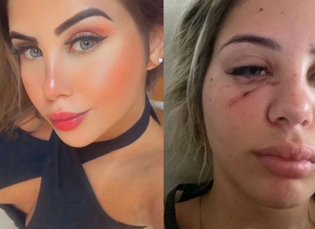 The model cries and asks her followers for help after being attacked by Vanderlei Bambam