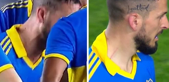 O pescoço direito de Benedetto antes e depois do intervalo