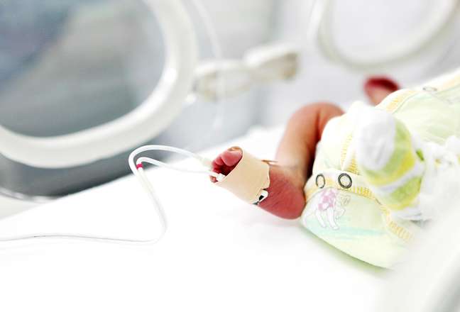 3D printing helps save the baby’s life without part of his skull 3D printing helps save the baby’s life without part of his skull
