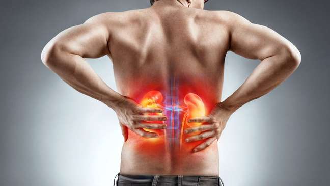 Kidney stone: what it is, prevention and how to identify the problem Kidney stone: what it is, prevention and how to identify the problem