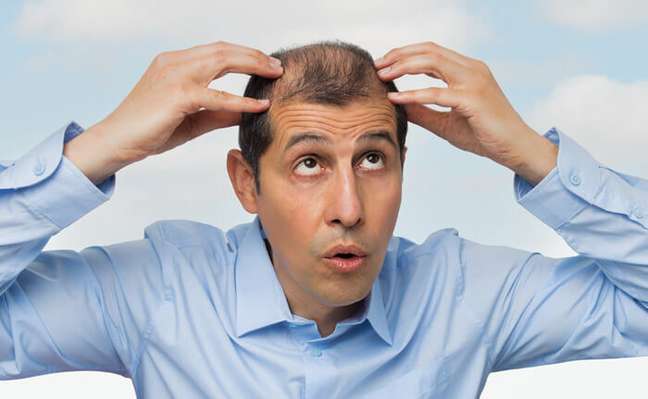 Does the home office cause hair loss?  The doctor says yes