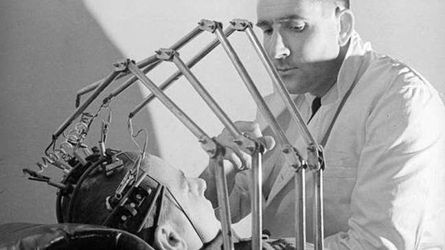 As primeiras tentativas de verificar sinais de vida inclu&iacute;ram fixar pin&ccedil;as aos mamilos das pessoas