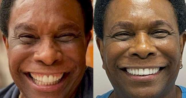Exclusive: Neguinho’s new smile from Beija-Flor