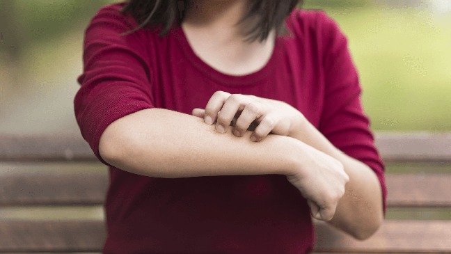 Atopic dermatitis: what it is, symptoms and how to avoid the condition Atopic dermatitis: what it is, symptoms and how to avoid the condition