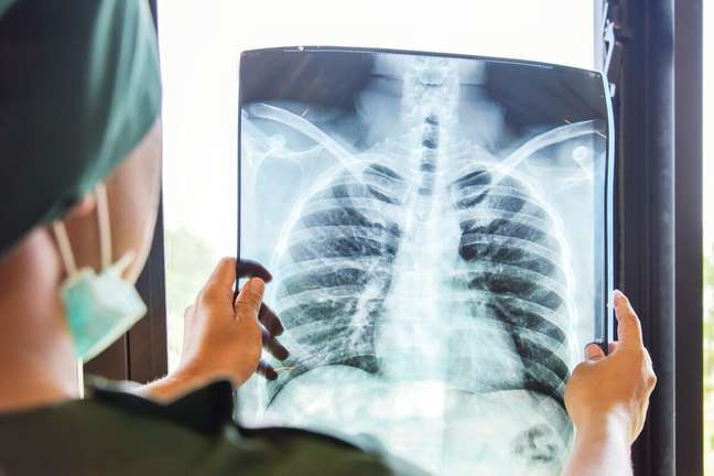Arterial diseases caused by smoking have lifelong consequences Arterial diseases caused by smoking have lifelong consequences