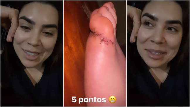 Naiara Azevedo gets five stitches on her toe when stepping on a knife
