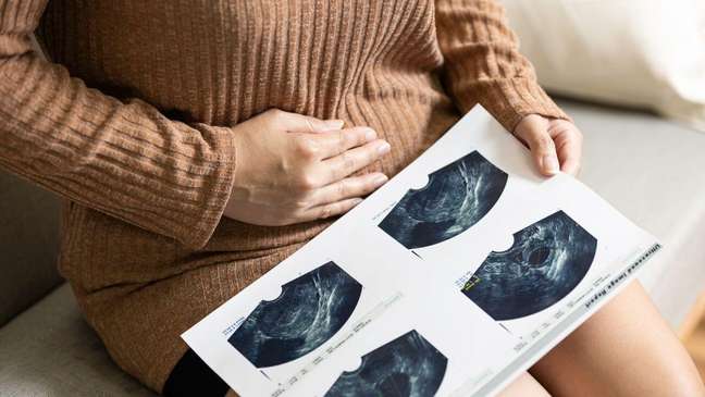 Endometriosis is often diagnosed late. 