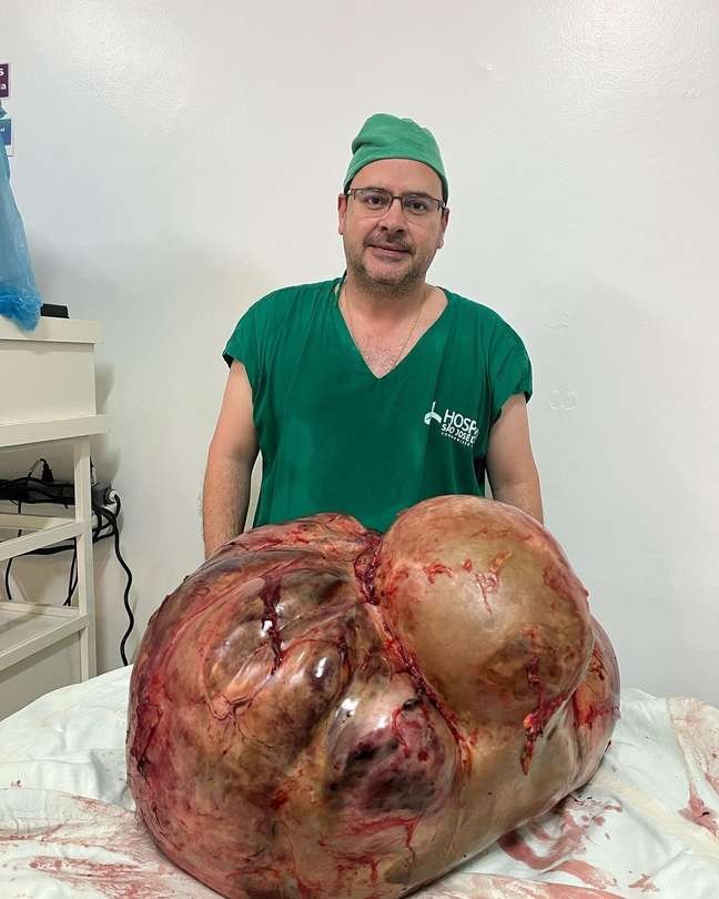 A cirurgia demorou cerca de duas horas, envolvendo cerca de 13 profissionais para retirar o tumor que pesava 46 kg