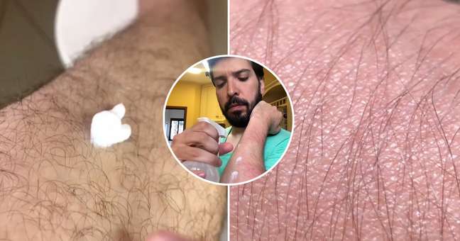 Trick to easily moisturize hairy skin Trick to easily moisturize hairy skin