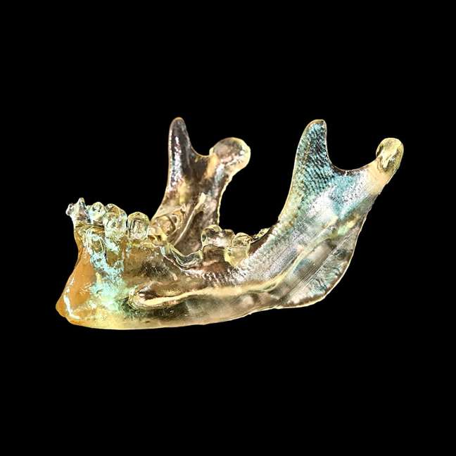Mand&iacute;bula para treinamento de implantodontia.