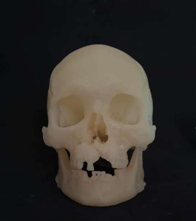 _Impress&atilde;o 3D do escaneamento de um cr&acirc;nio em exposi&ccedil;&atilde;o no Museu de Hist&oacute;ria da Su&eacute;cia.