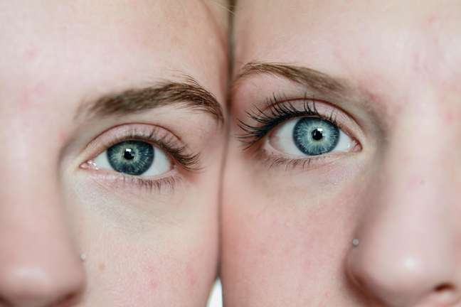 Gêmeos de pais diferentes são casos extremamente raros; um deles aconteceu em Goiás Gêmeos de pais diferentes são casos extremamente raros; um deles aconteceu em Goiás