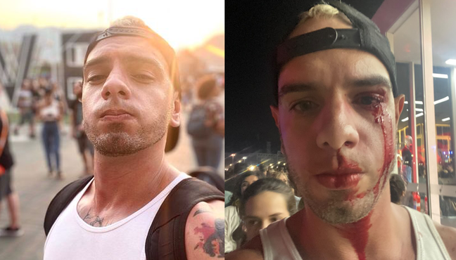 The photographer says he was attacked in Rock in Rio by the teenager’s father after being bumped into