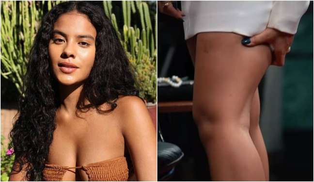 Bella Campos reveals that she was bitten in the leg by a Pantanal alligator Bella Campos reveals that she was bitten in the leg by a Pantanal alligator