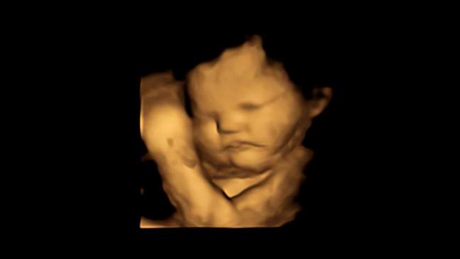 An unprecedented study records babies’ reaction to the taste of food while in the womb An unprecedented study records babies’ reaction to the taste of food while in the womb