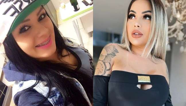 The Brazilian spends BRL 300,000 on plastic surgery to be “totally artificial”;  see before and after