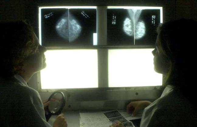 Performing mammography allows for early diagnosis of the disease, which increases the chances for improvement. Performing mammography allows for early diagnosis of the disease, which increases the chances for improvement.