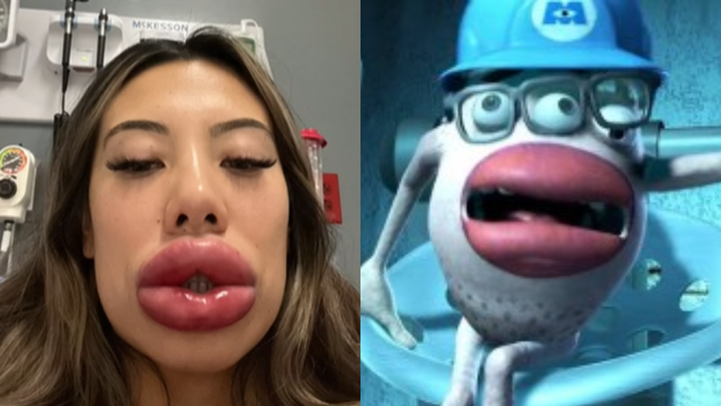 Basia Query, from Las Vegas, went viral online after having an allergic reaction and was compared to a cartoon character