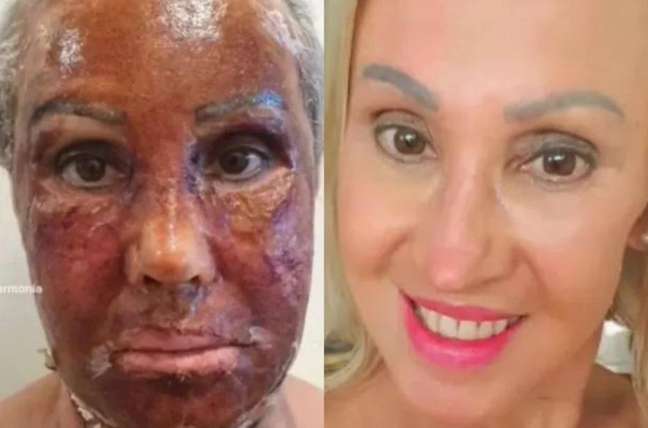 The woman’s “face swap” after the cosmetic procedure and the change goes viral on the web; video The woman’s “face swap” after the cosmetic procedure and the change goes viral on the web; video
