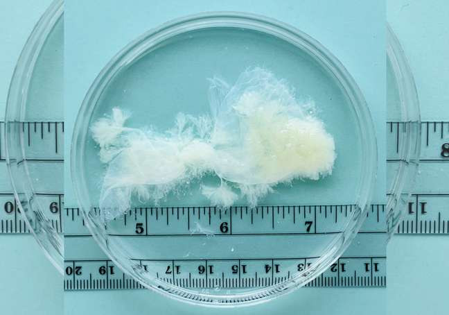 Real images show gestational material up to the ninth week of pregnancy Real images show gestational material up to the ninth week of pregnancy