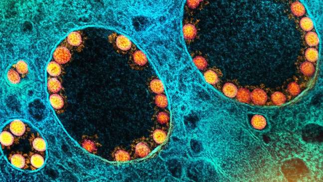 BQ.1: what is known about the omicron variant discovered in Brazil BQ.1: what is known about the omicron variant discovered in Brazil