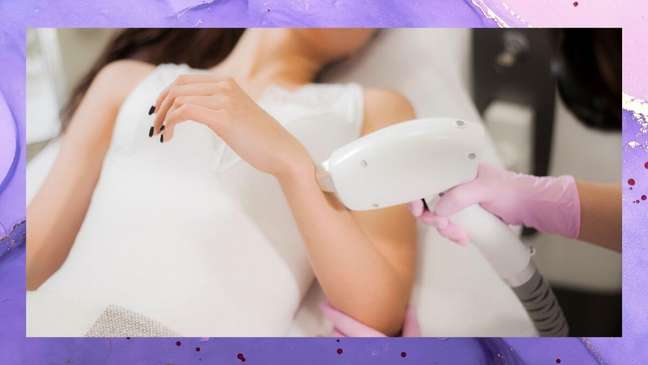 After all, can teenagers do laser hair removal?
