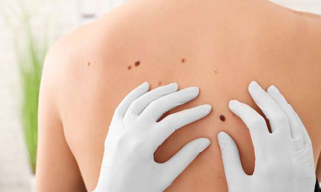 Orange December: Learn to protect yourself from skin cancer