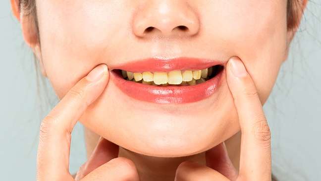 4 myths and truths about foods and drinks that turn yellow teeth