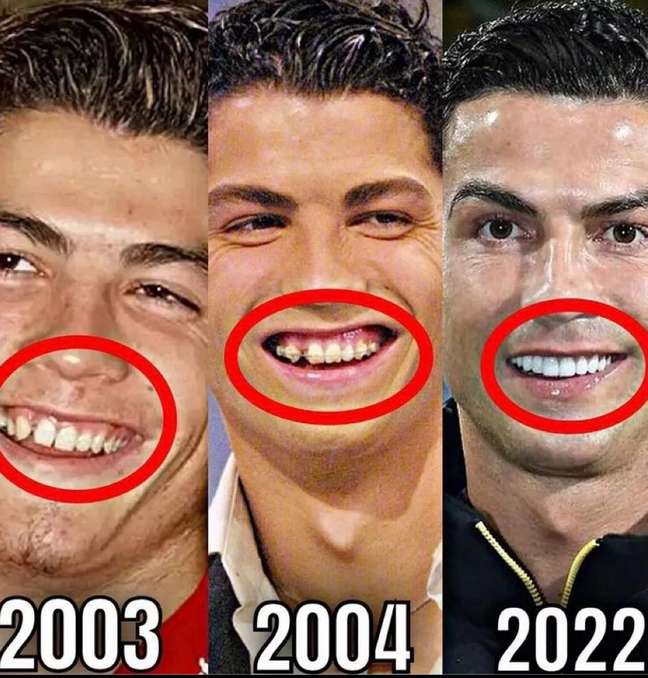 Cristiano Ronaldo’s photo with braces goes viral.  see the transformation